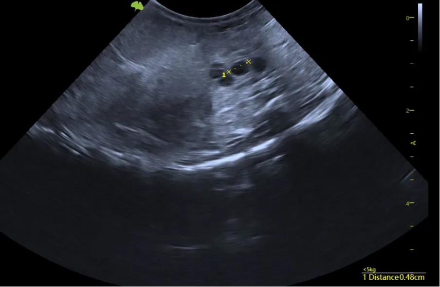 Stage 2 · Early Vitellogenesis