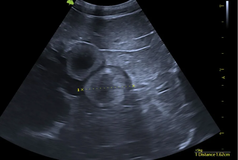 Stage 3 · Mid Vitellogenesis