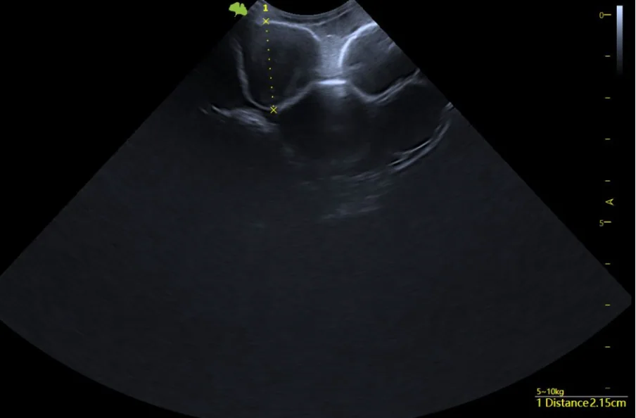 Stage 4 · Late Vitellogenesis / Pre-Ovulatory