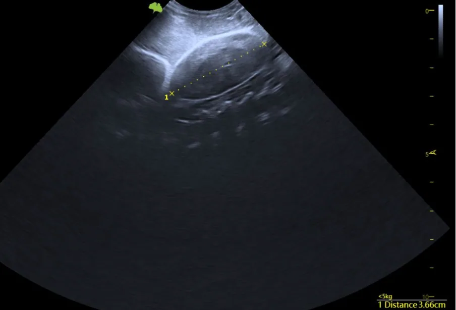 Stage 5 · Post-Ovulatory / Oviductal Eggs