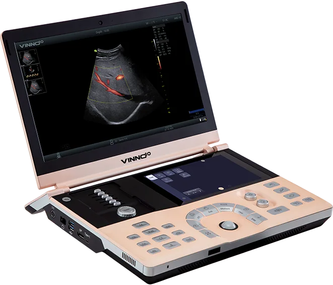 Vinno portable veterinary ultrasound machine